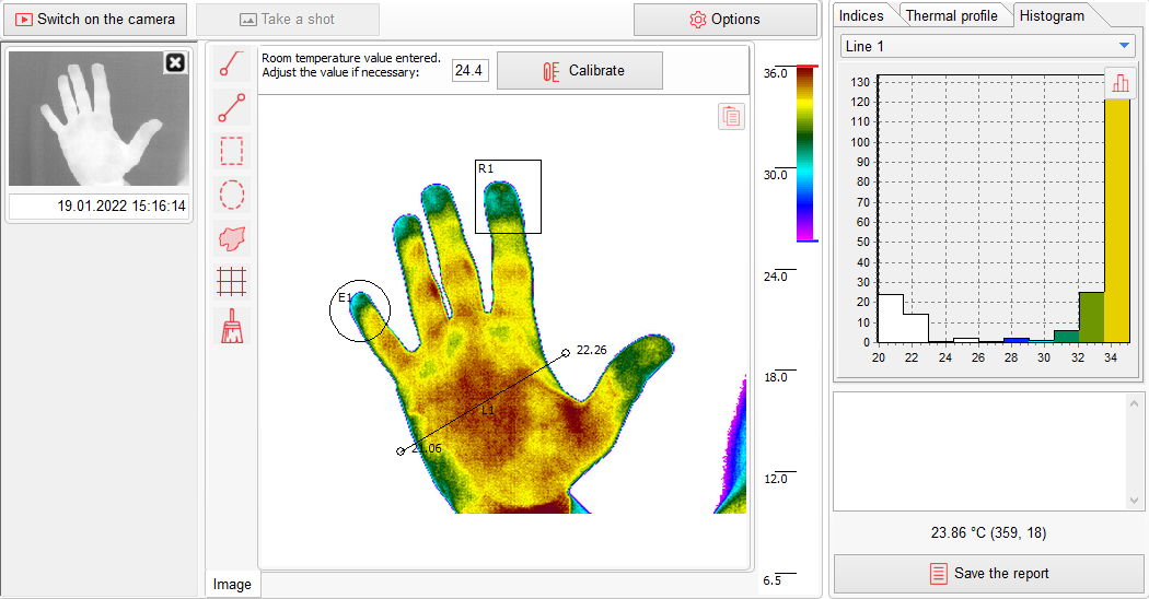 Thermography Histogram Thermography Histogram