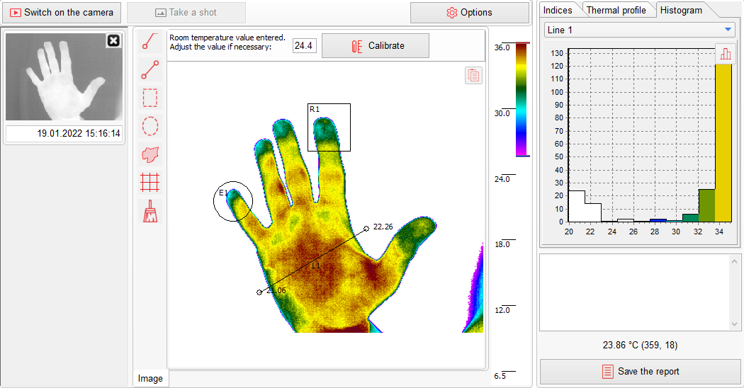 Thermography Histogram