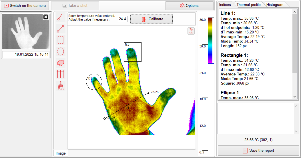 Thermography indices Thermography indices