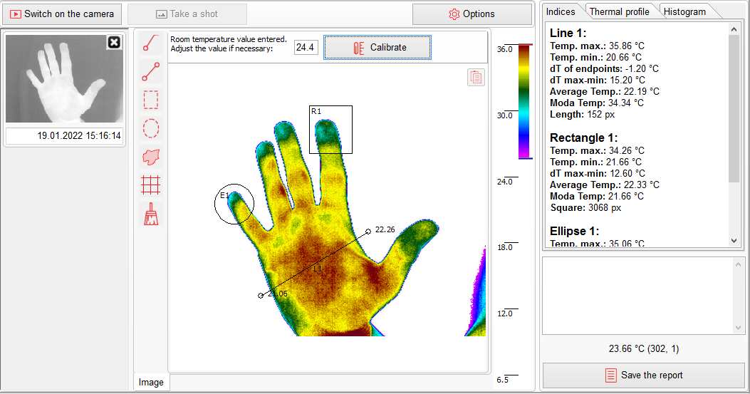 Thermography indices